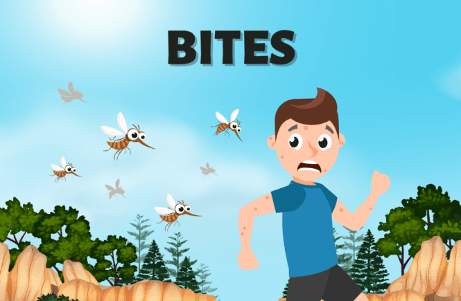 dealing with insect bites