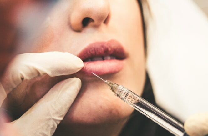 Botox and fillers