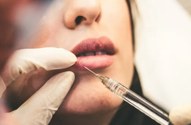 Botox and fillers